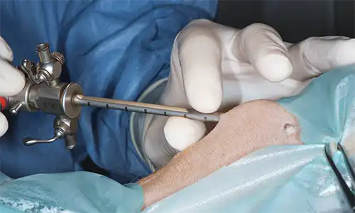 Endoscopia (Centro Veterinario Madrid Exóticos)